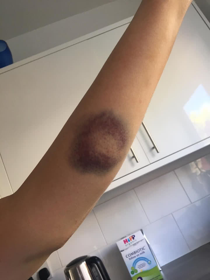Para evitar que su exnovio salga de la cárcel mujer publica las fotos de la golpiza que le propinó