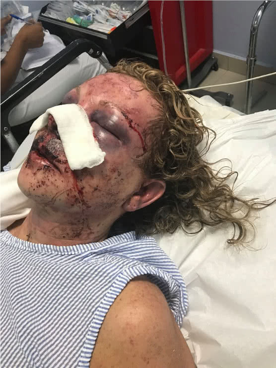 La turista que fue raptada, golpeada y estrangulada hasta la muerte por quien sería el empleado de un hotel