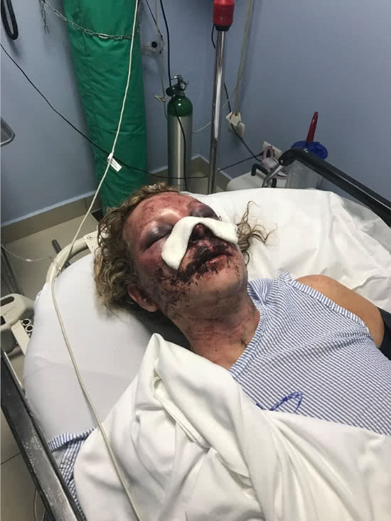 La turista que fue raptada, golpeada y estrangulada hasta la muerte por quien sería el empleado de un hotel